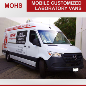 mohs custom van