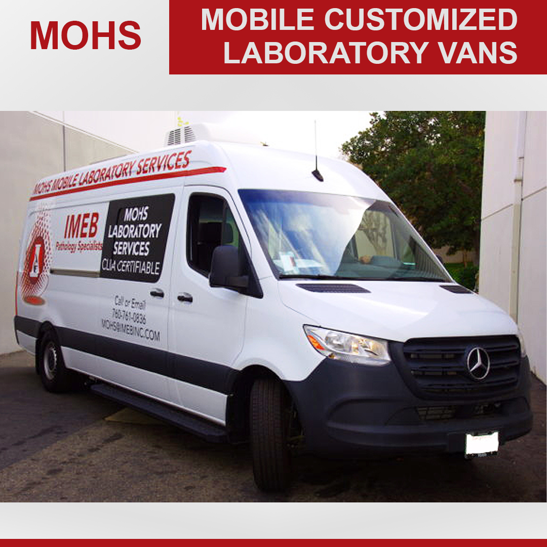 mohs custom van